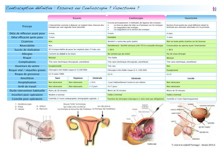 Contraception Définitive Stérilisation INFOPATIENT FORMAGYN 2015 | PDF