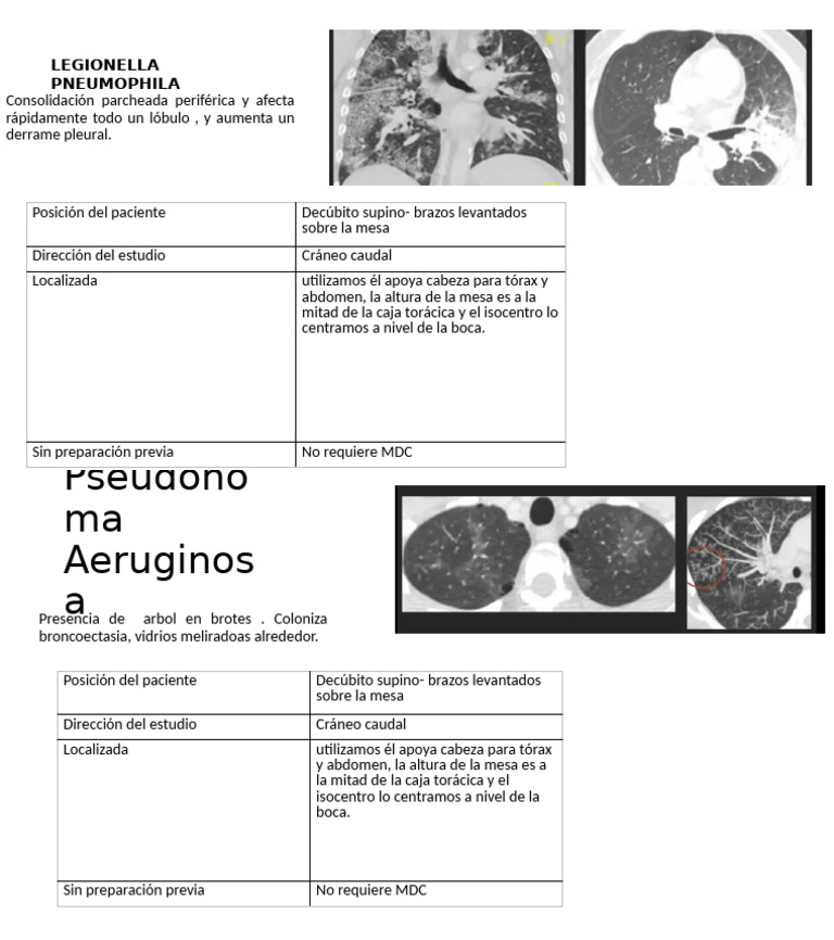 Patologias TAC | PDF