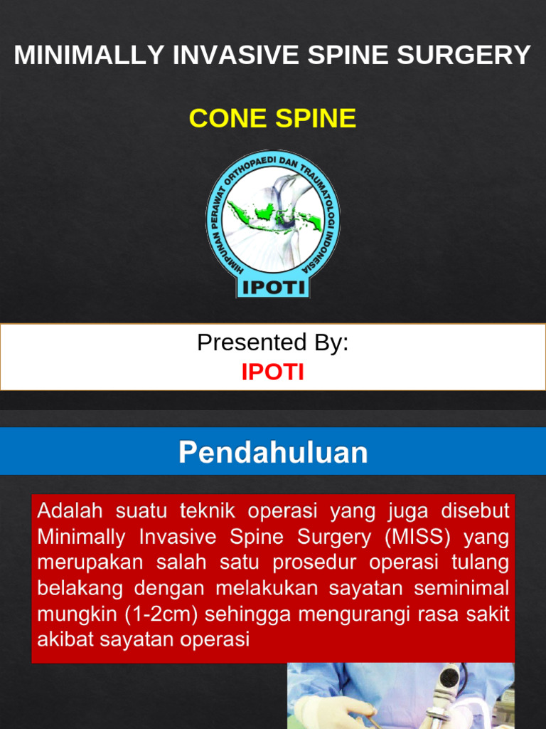 Minimally Invasive Spine Surgery | PDF