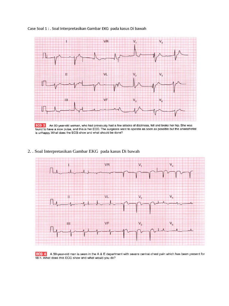 Interpretasi Gambar EKG Kasus | PDF | Science & Mathematics