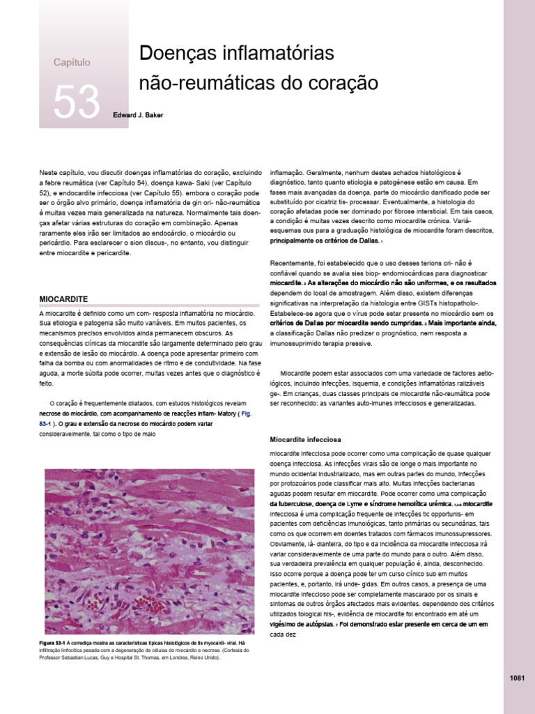 53 Non-Rheumatic Inflammatory Diseases of The Heart - En.pt | PDF