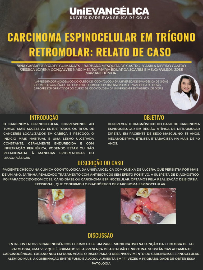 carcinoma-espinocelular-em-tr-gono-retromolar-relato-de-caso-pdf