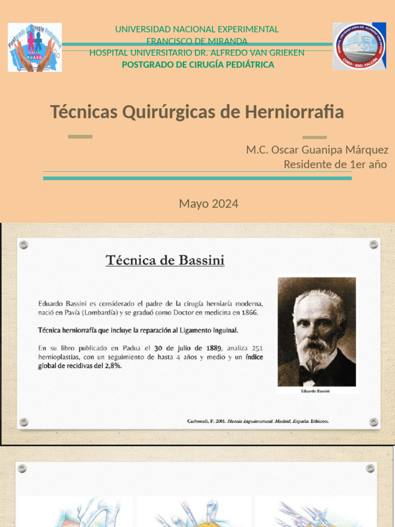 Tecnica de Bassini y Shouldice | PDF