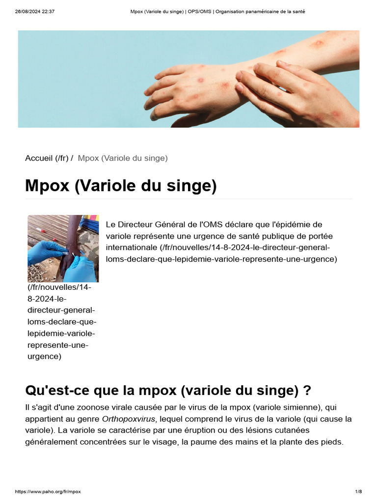 Mpox (Variole Du Singe) - OPS - OMS - Organisation Panaméricaine de La ...