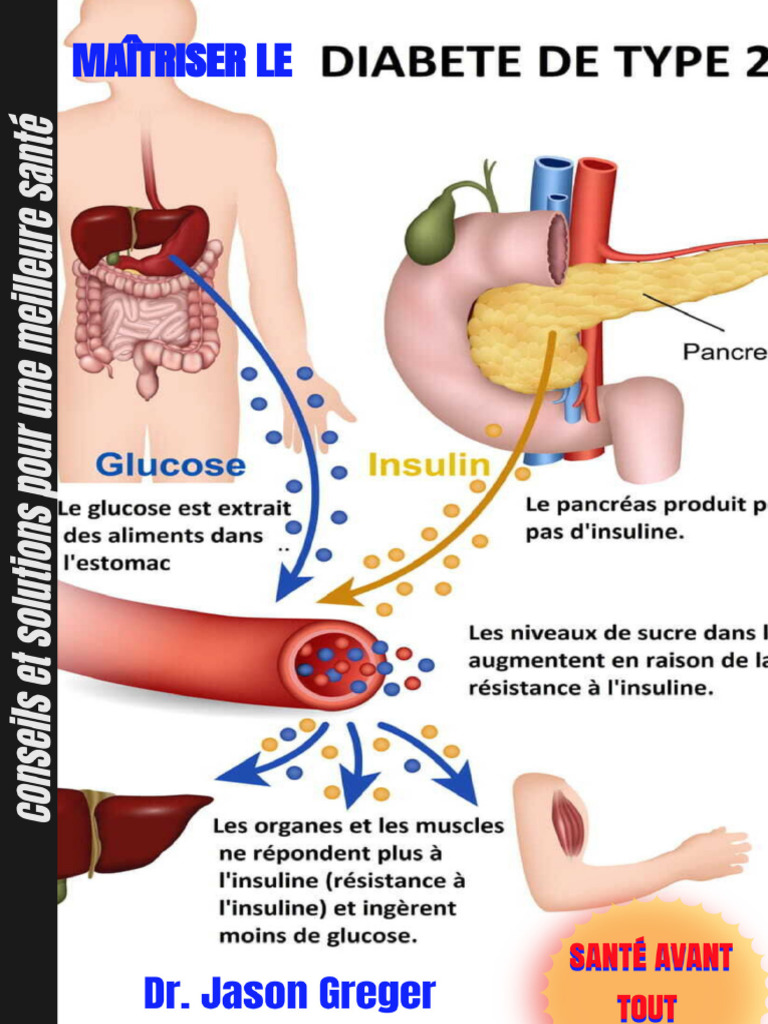Maîtriser Le Diabète de Type 2 - Conseils Et Solutions Pour Une ...