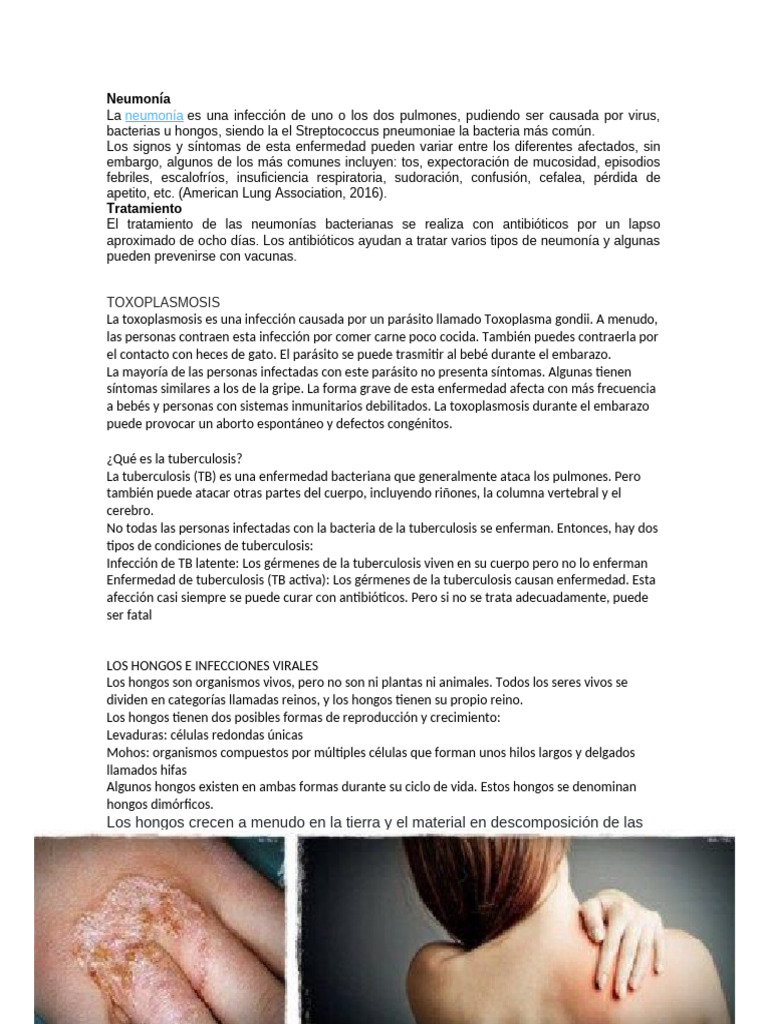Neumonía | PDF