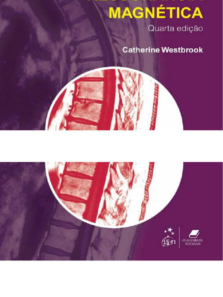 Dor abdominal - intussusceção e outras deslocações do intestino -  Medizinonline, image size:768x1024