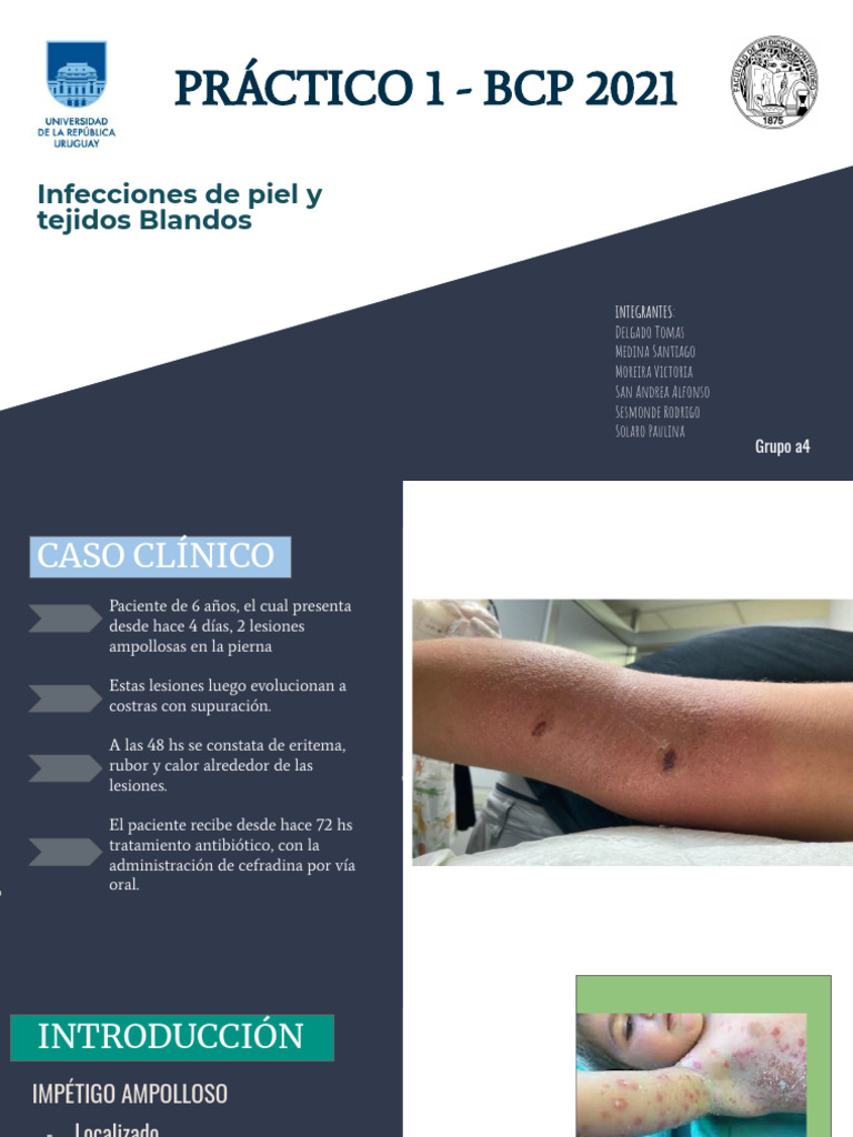 Pptpractico BCP | PDF