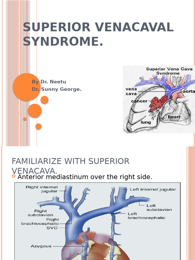 Svcs | PDF