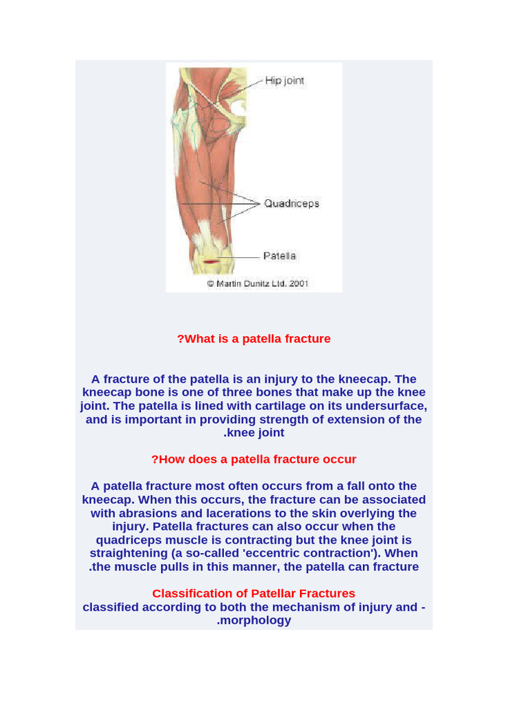What Is A Patella Fracture | PDF