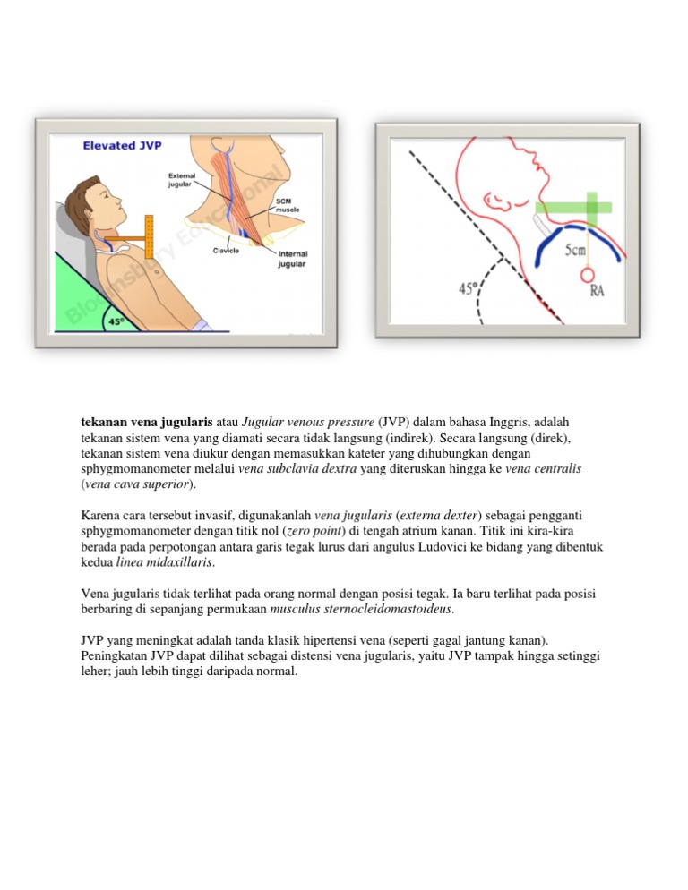 Tekanan Vena Jugularis Atau Jugular Venous Pressure (JVP) Dalam Bahasa ...