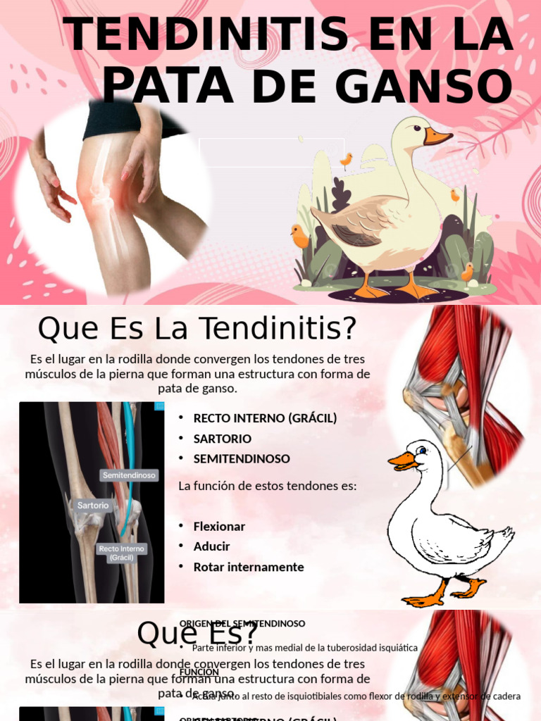 Tendinitis en La Pata de Ganso | PDF