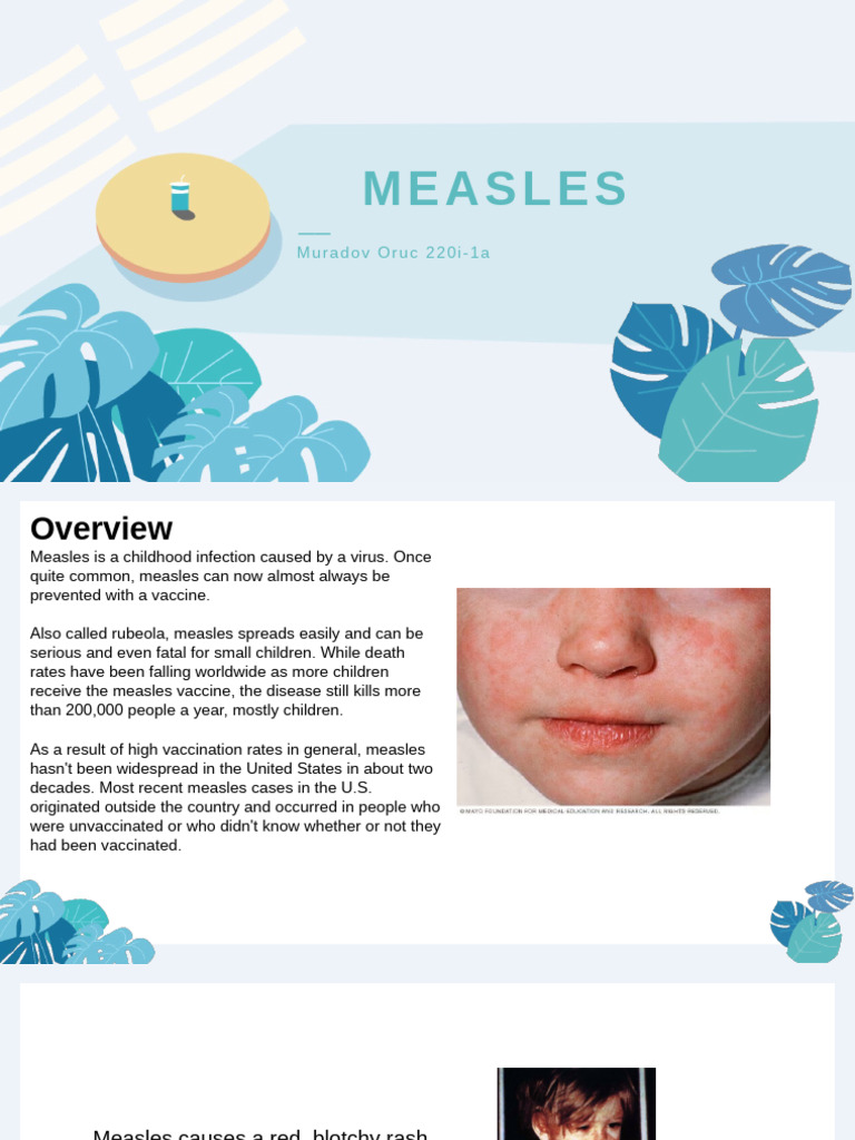 Measles (1) 6 | PDF