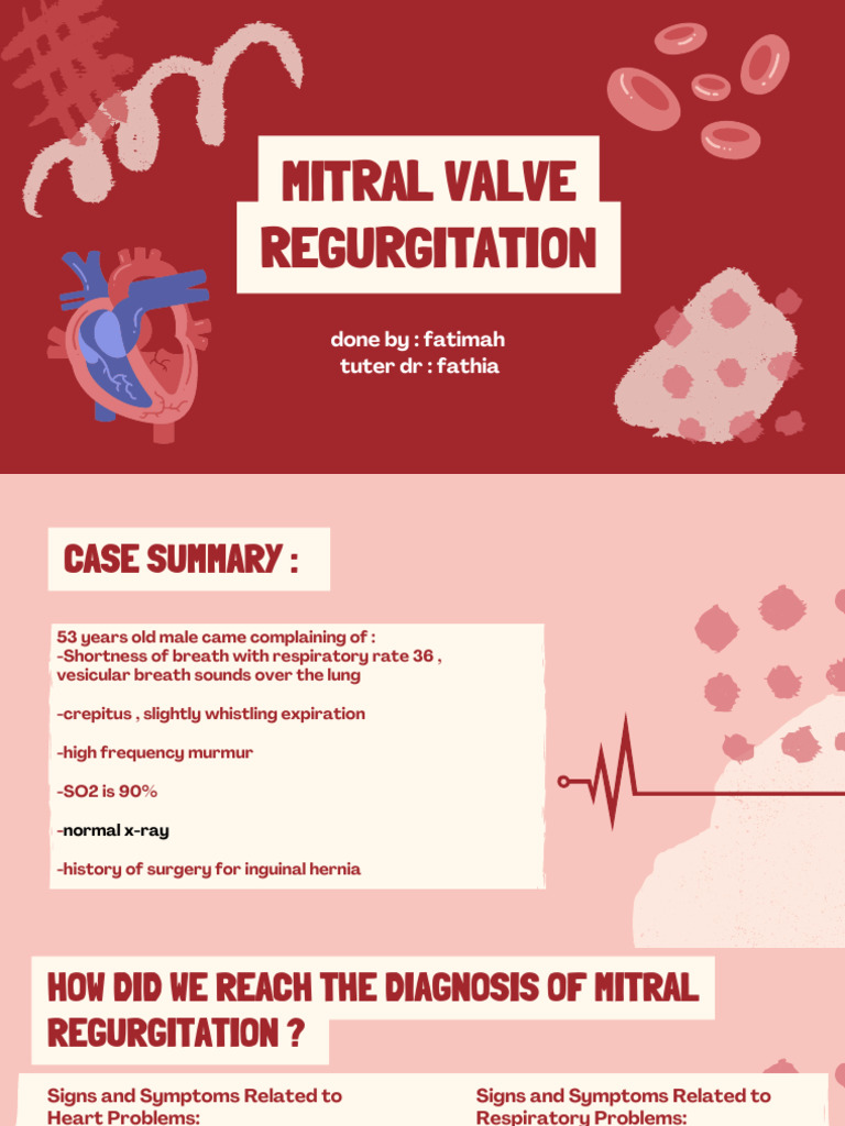 Mitral Valve Regurgitation by Fatimah | PDF