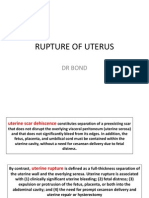 Rupture of Uterus
