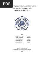 Download Segmentasi Iris Mata Menggunakan Metode Deteksi Tepi Dan by Hanatakaruki Akihisa Aida SN76453020 doc pdf