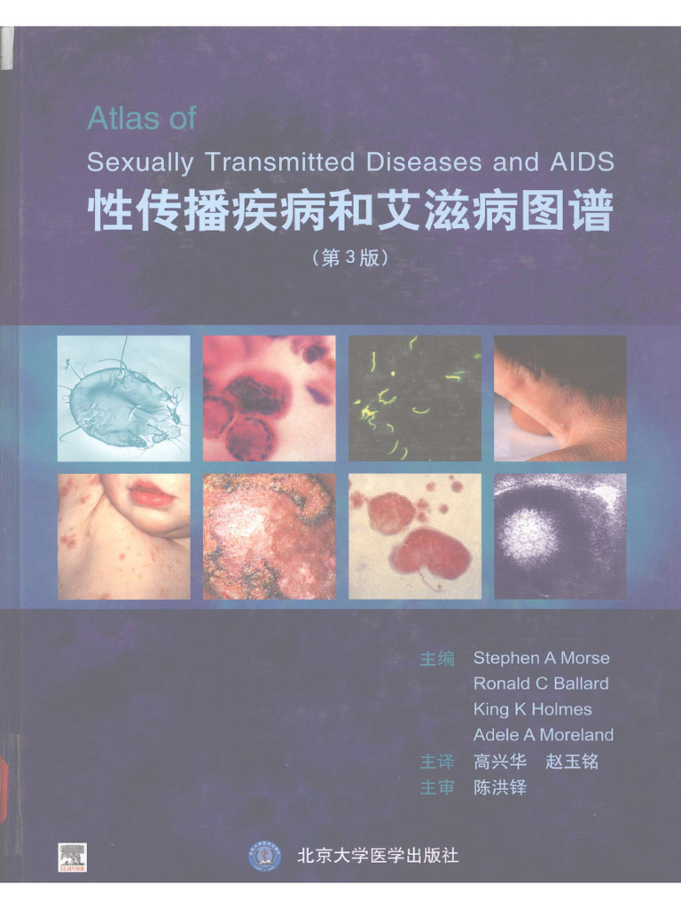 性传播疾病和艾滋病图谱 第3版 | PDF