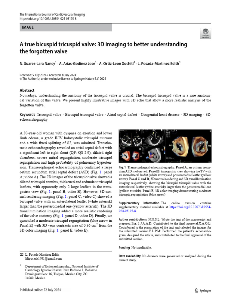 A True Bicuspid Tricuspid Valve | PDF