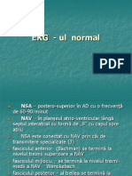 EKG Normal