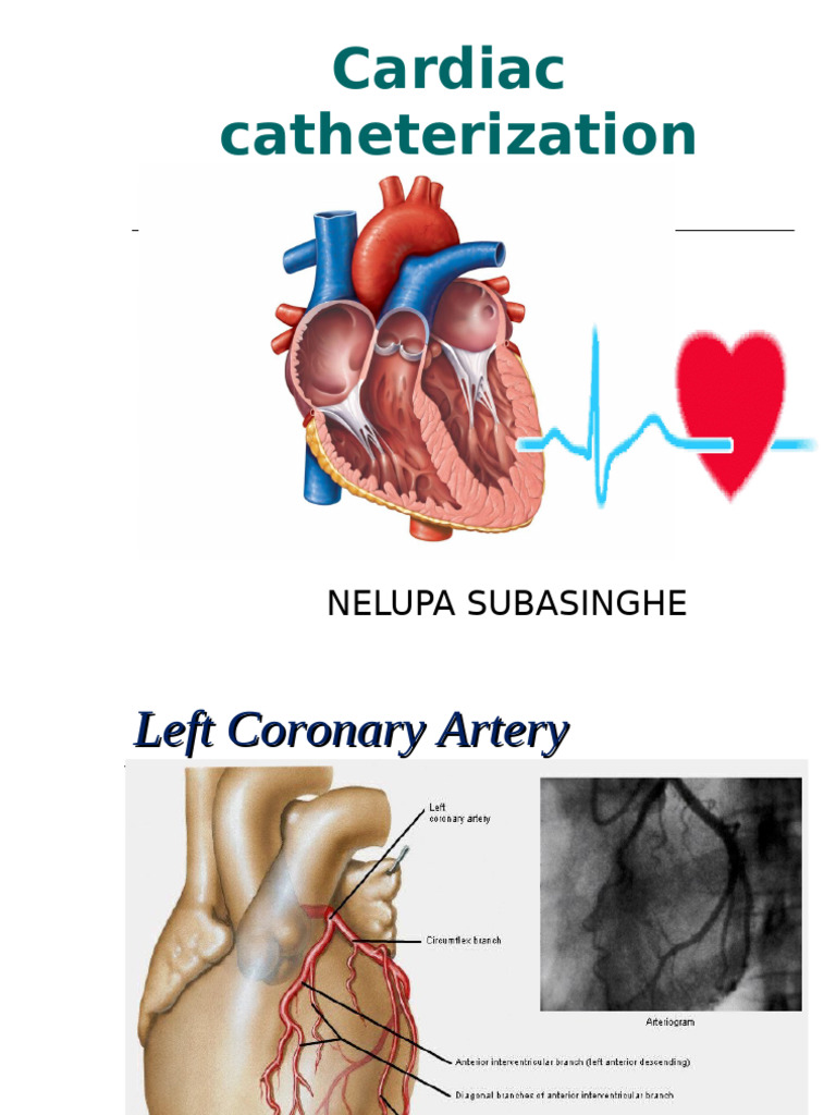 Cardiac Catheterization Overview Guide | PDF | Heart | Coronary Circulation