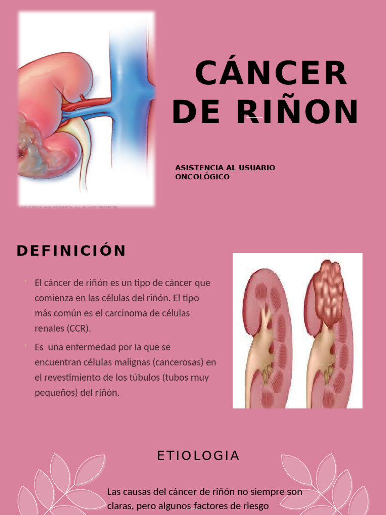 Cancer Al Riñon | PDF