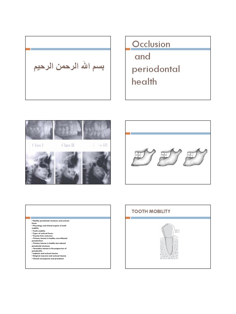 Occlusal Trauma and Tooth Mobility Analysis | PDF | Human Tooth ...