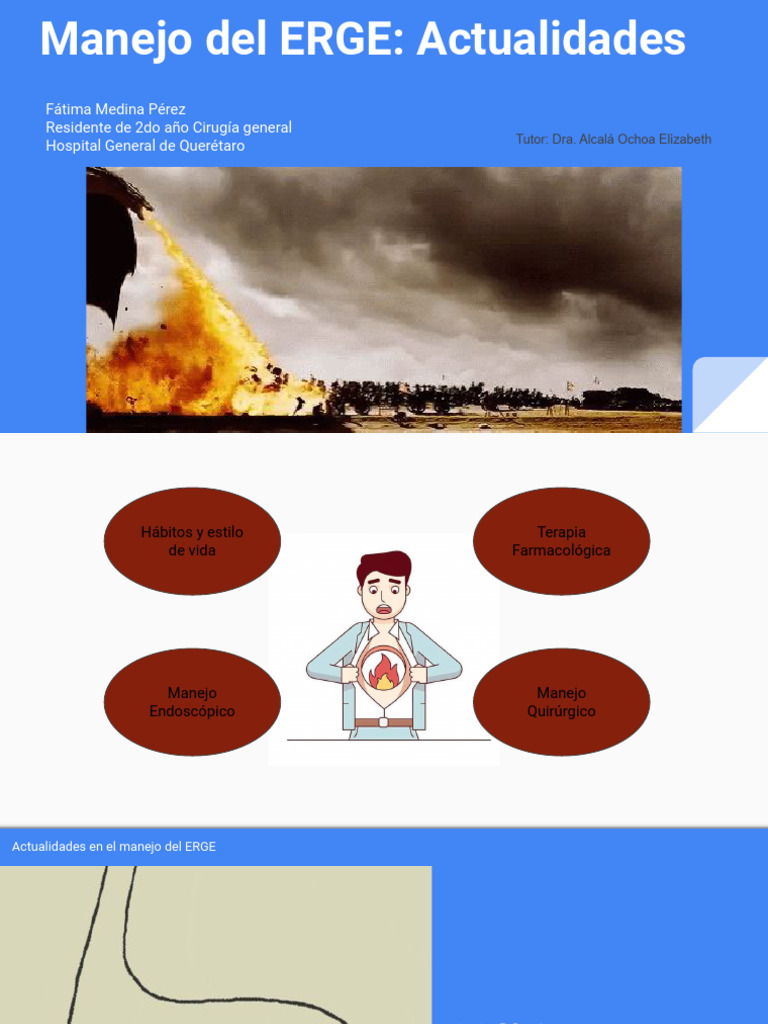 Actualidades ERGE | PDF