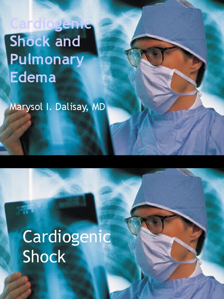 Cardiogenic Shock and Pulmonary Edema | Shock (Circulatory) | Heart