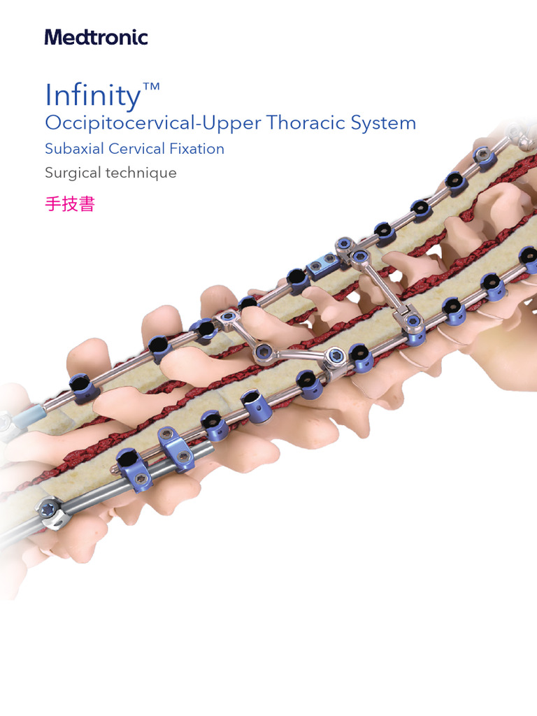 Infinity | PDF
