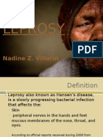 Leprosy by