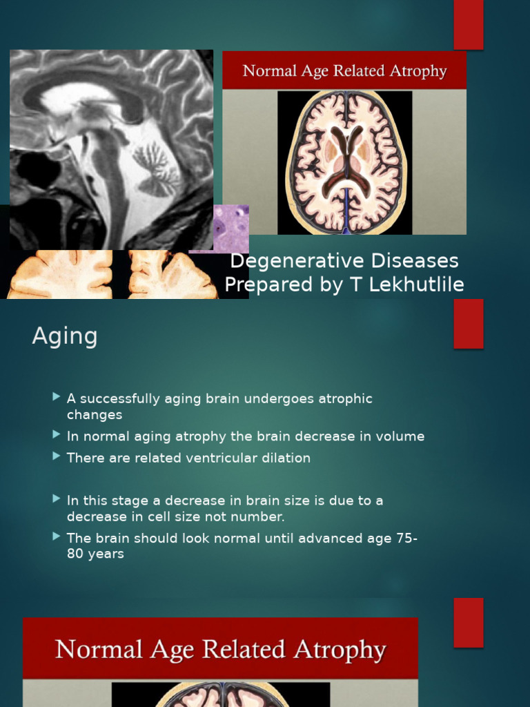 Neurodegenerative Diseases | PDF