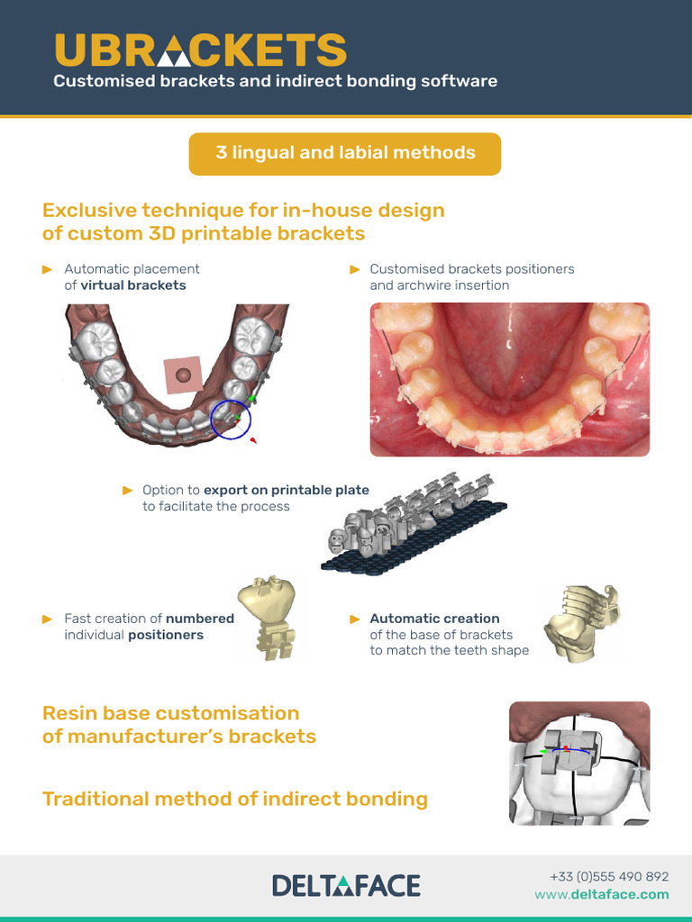 Ubrackets | PDF