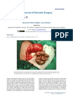 Sequestered Bowel in Jejunoileal Atresia