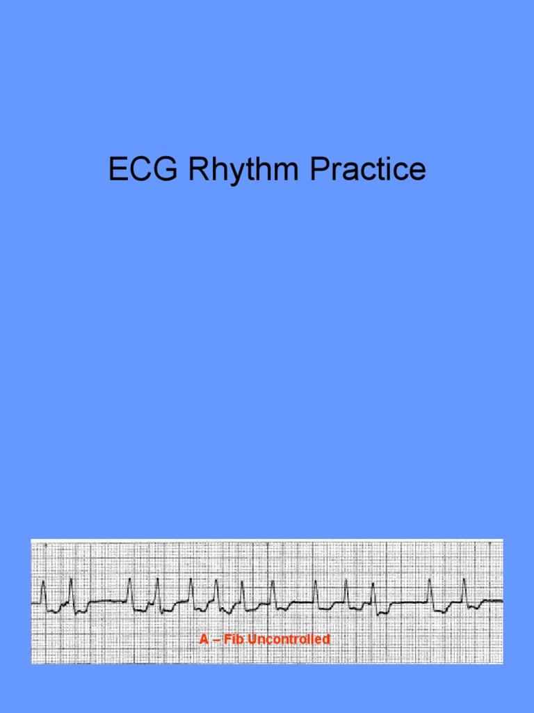 Practice Rhythms 2 | PDF