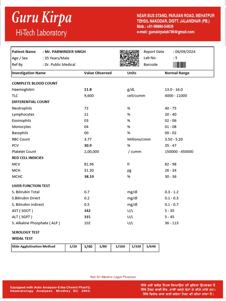 Patient Name: Mr. Parwinder Singh: Slide Agglutination Method 1/20 1/80 ...