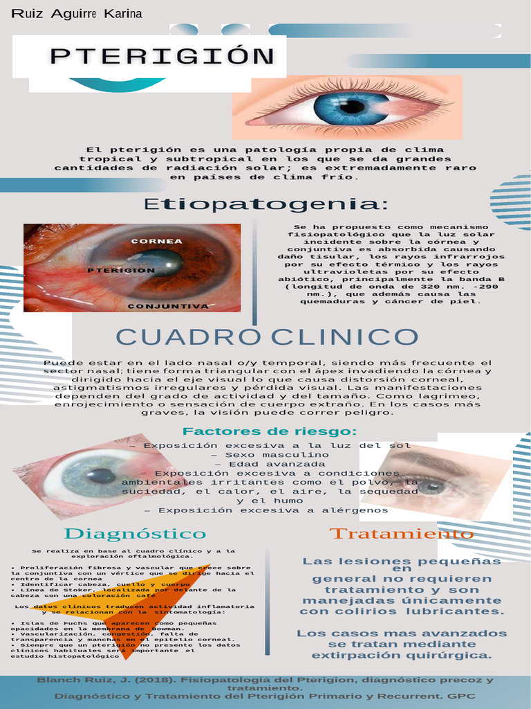 Pterigión | PDF