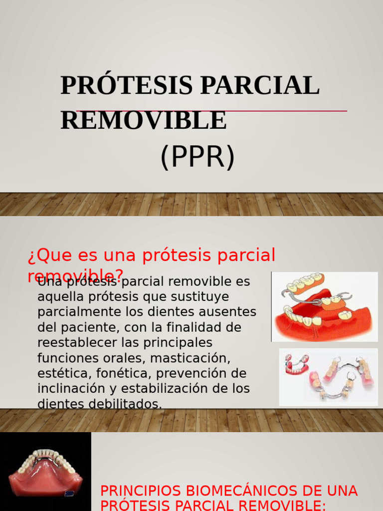 Prótesis Parcial | PDF