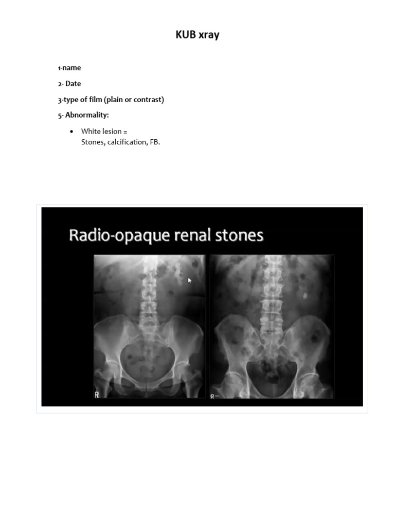 X Rays Kub Radiology Report : Free library of best-practice report ...