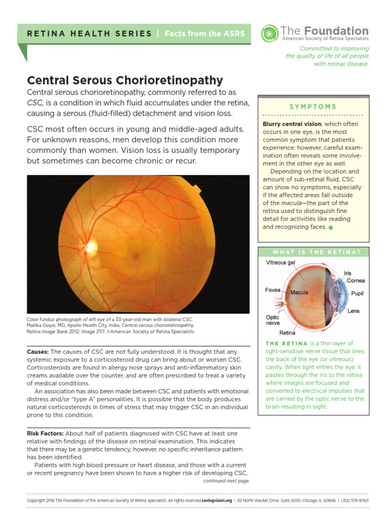 Fact Sheet 18 Central Serous Chorioretinopathy New | PDF