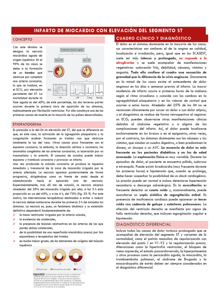 Infarto de Miocardio Con Elevación Del ST | PDF