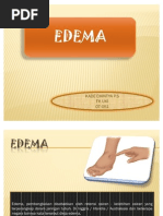 Download ppt Edema by Kade Chintya Pramita Sari SN76826079 doc pdf