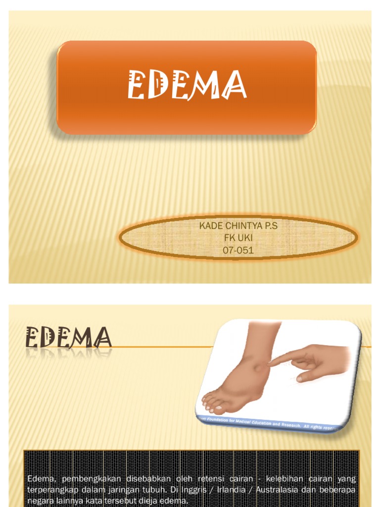 Edema | PDF | Sains & Matematika