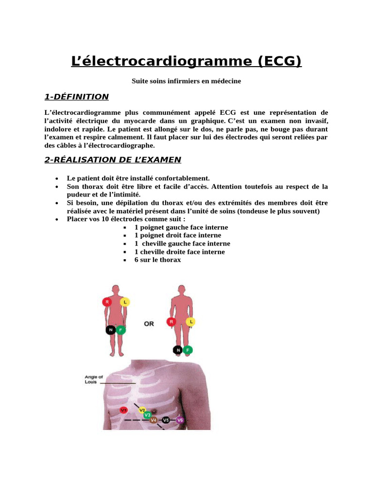 L'électrocardiogramme (ECG) : 1-Définition | PDF