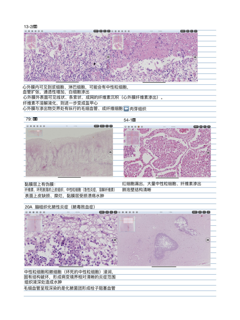 炎症Inflammation | PDF