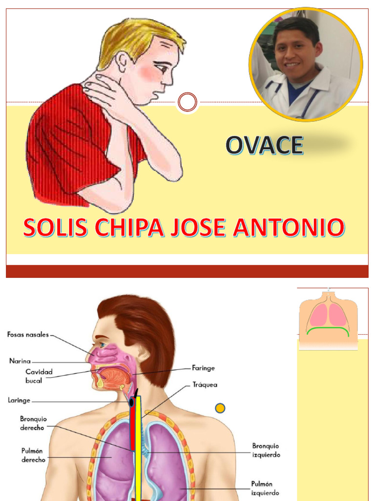 7ma OVACE | PDF