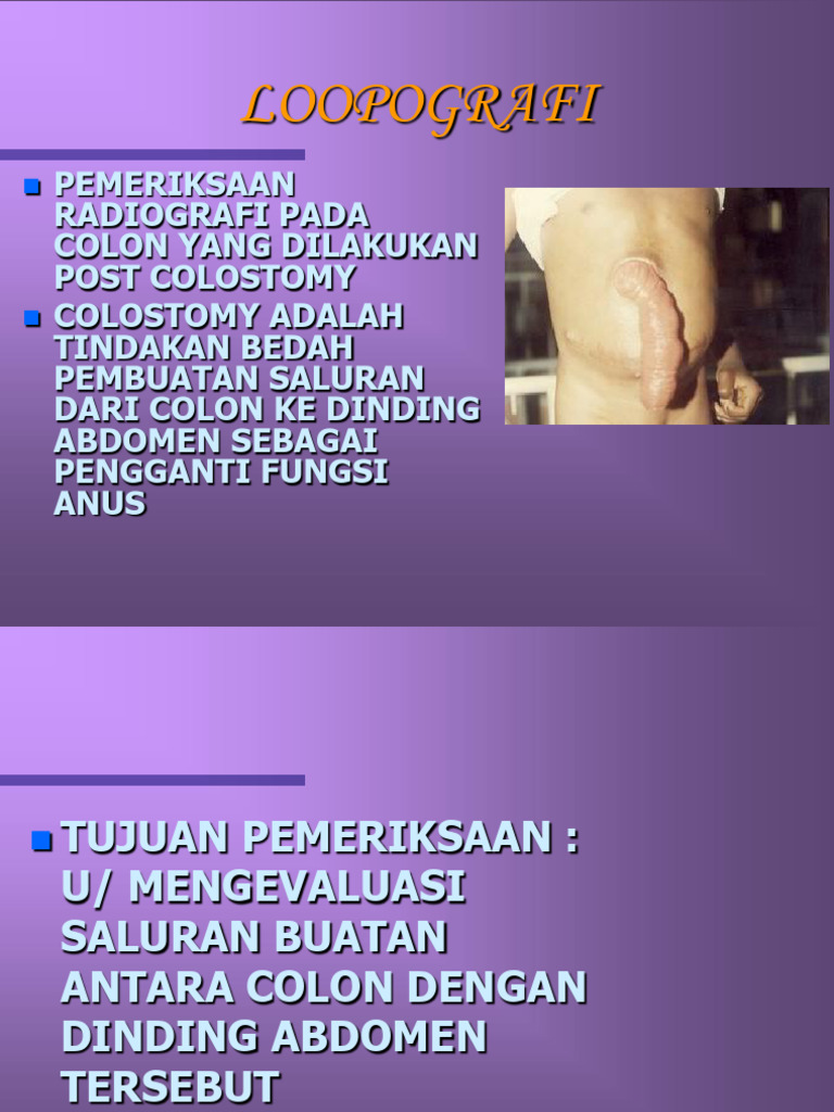 LOOPOGRAFI | PDF