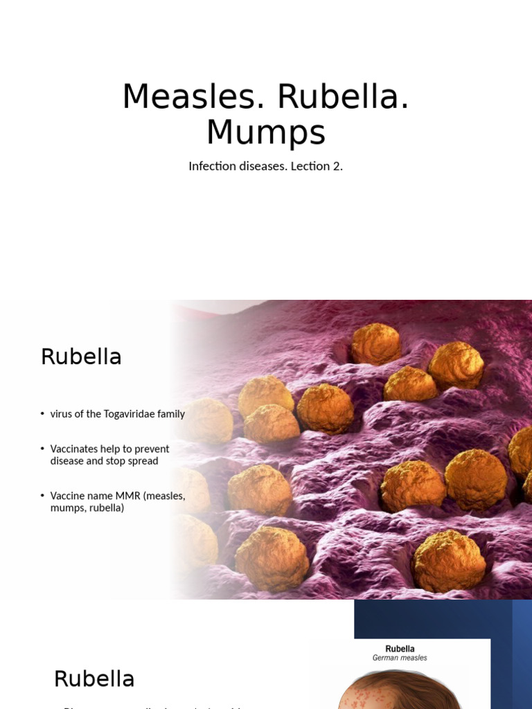 Measles | PDF