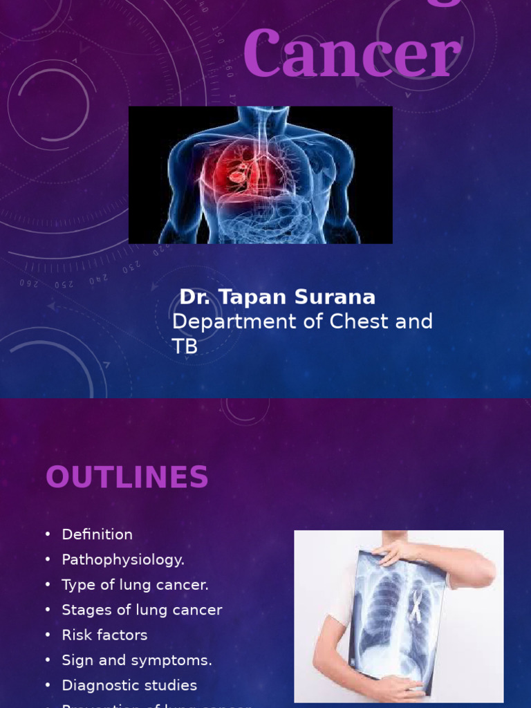 Lung Cancer PPT Revised | PDF