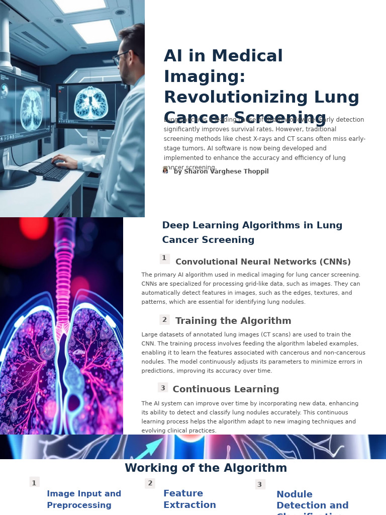 AI in Medical Imaging Revolutionizing Lung Cancer Screening | PDF