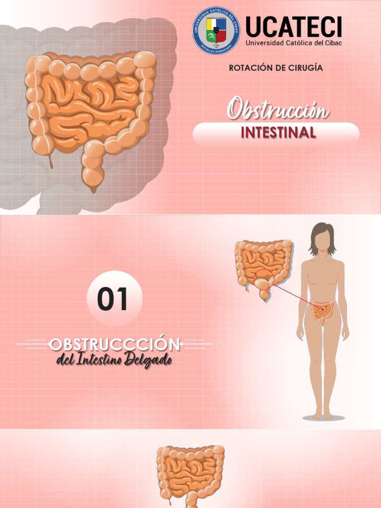 Oclusión Intestinal - Diapositiva | PDF